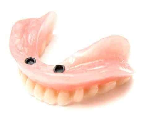 Implant Dentures