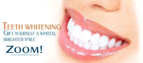 Teeth Whitening The Woodlands Texas