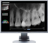 Digital X ray results example