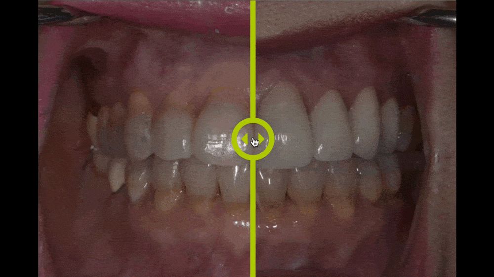 Smile Gallery Instructions