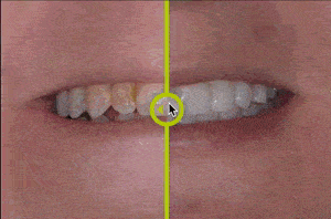 Interactive Tooth Gallery Demo