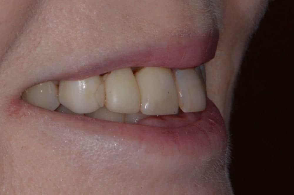Before
