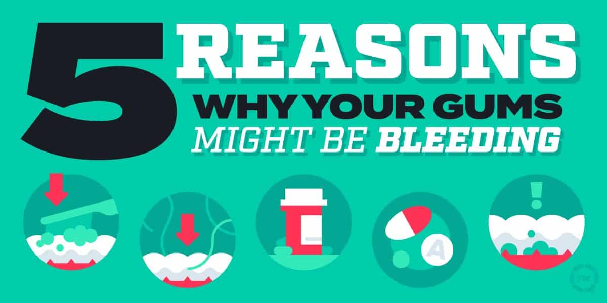 reasons for bleeding gums