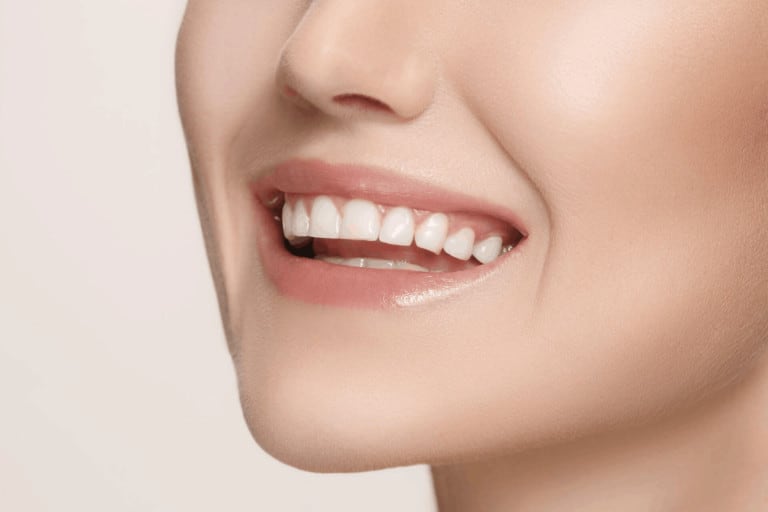 teeth whitening dental hygiene