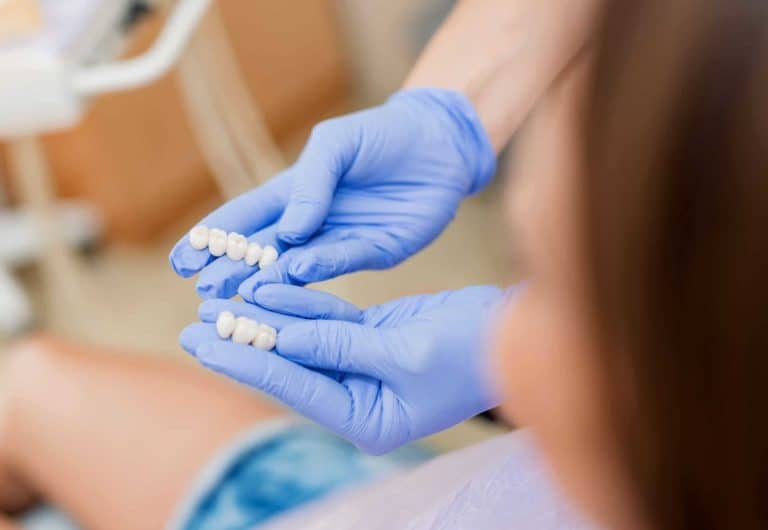 dentist showing samples of Veneers and Crowns teeth