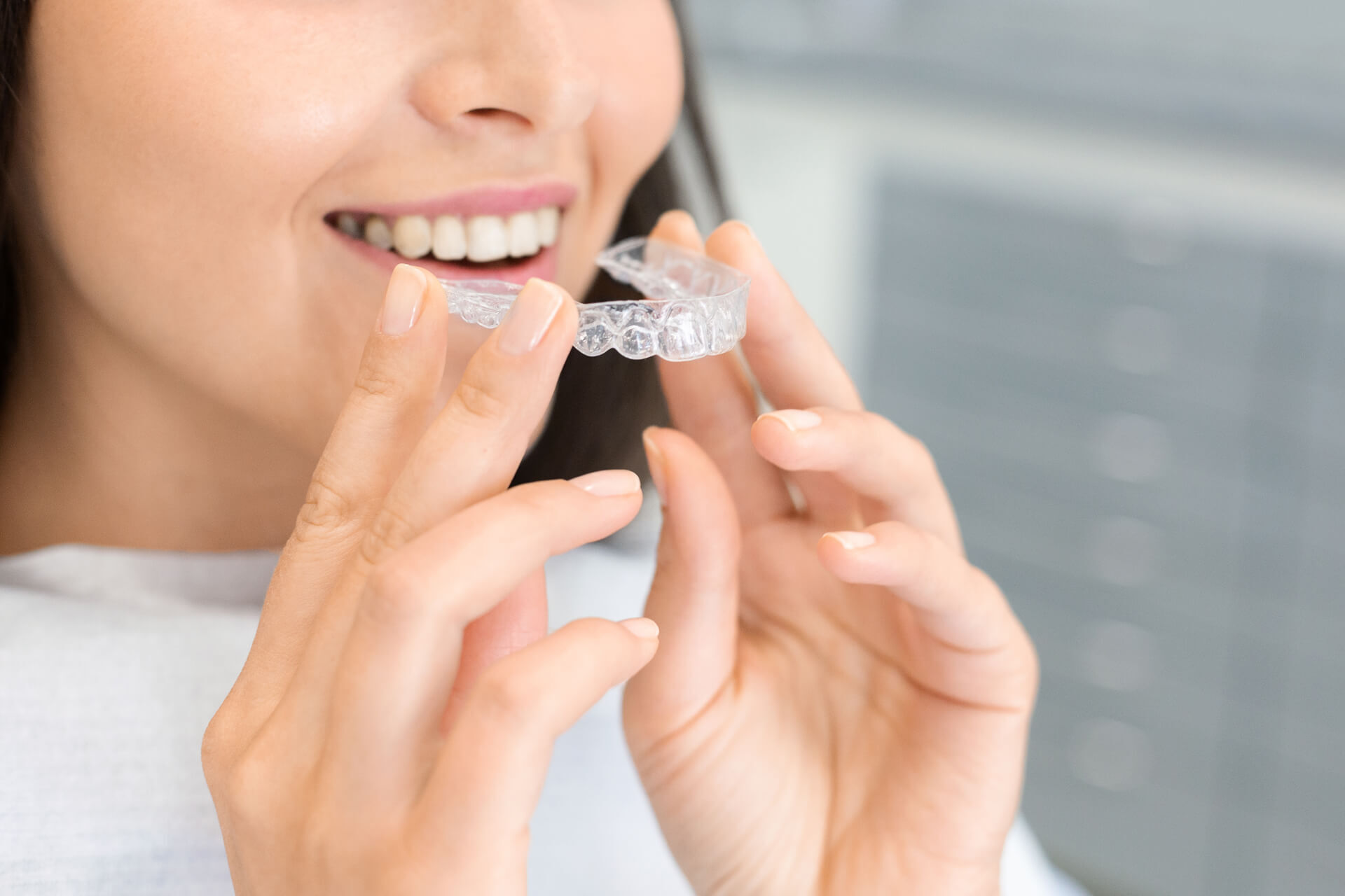 What Are the Benefits of Invisible Braces?