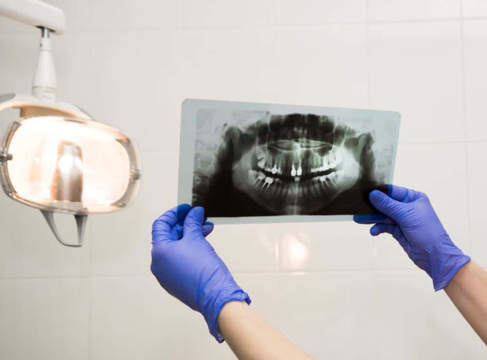 Printed xray in dentists hands