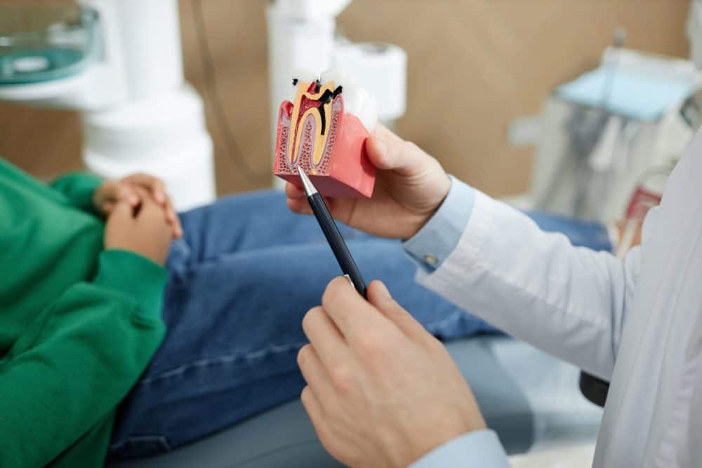 root canal