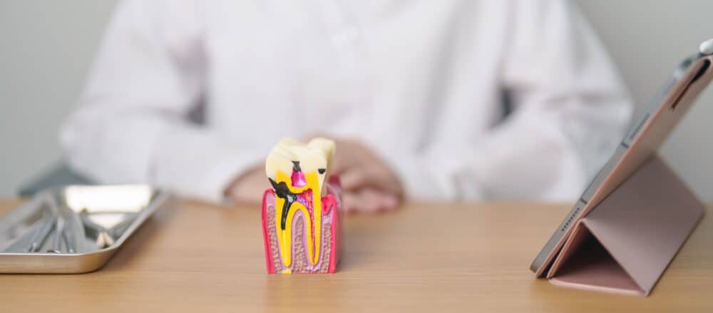 choosing the right dentist for a root canal treament
