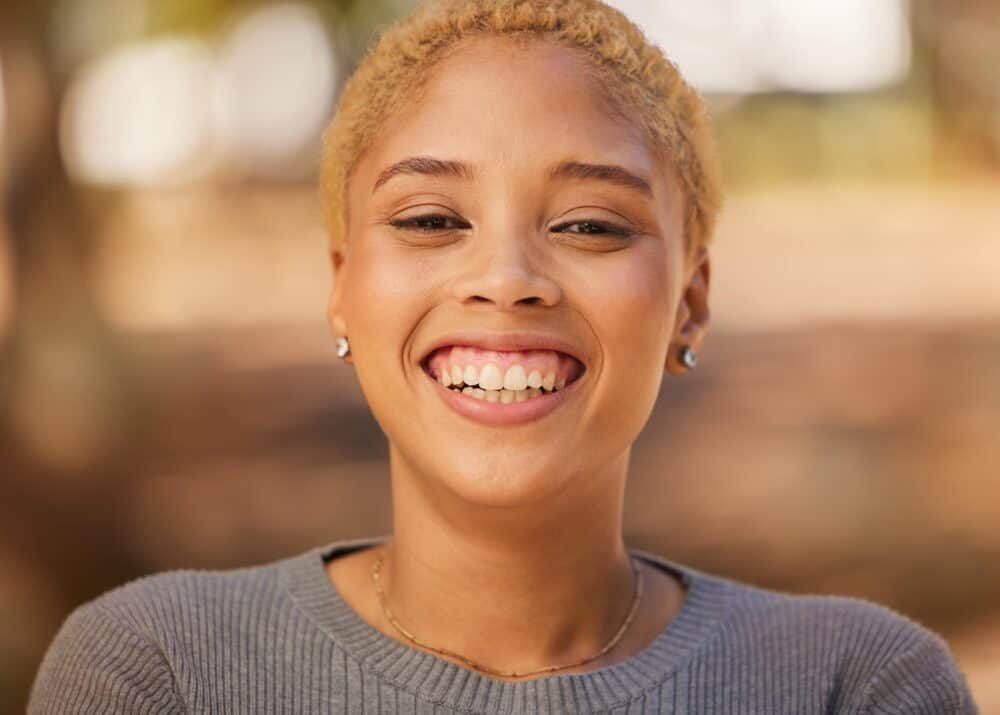 gummy smile