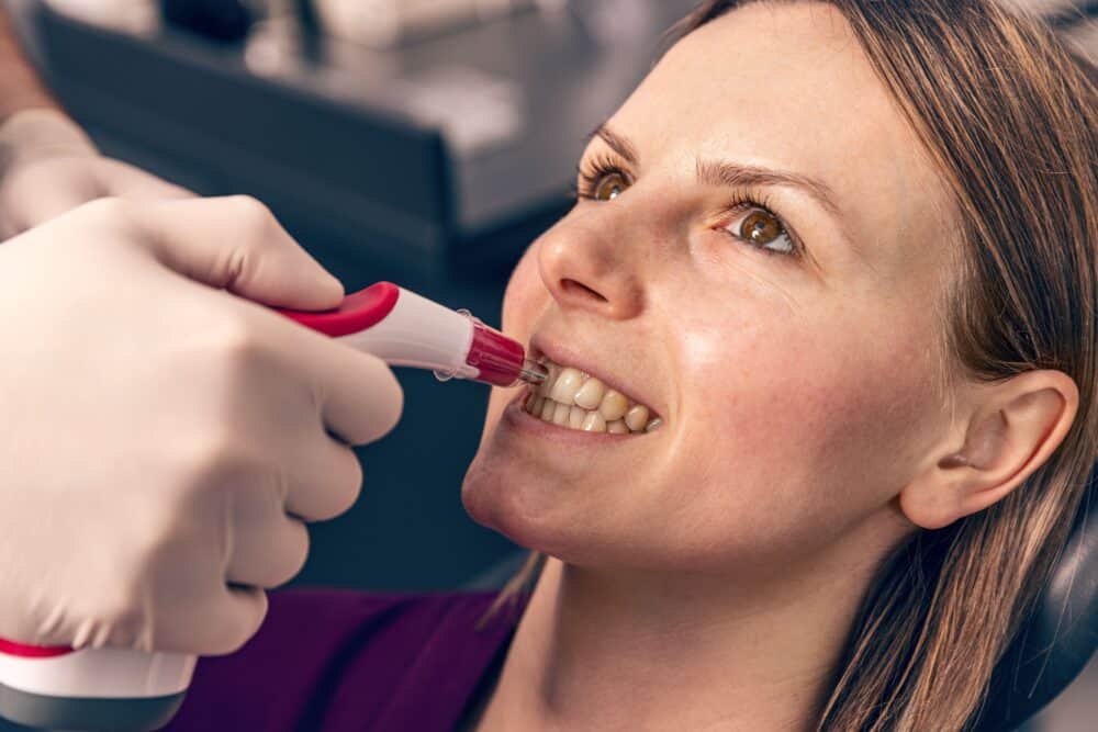 professional teeth whitening
