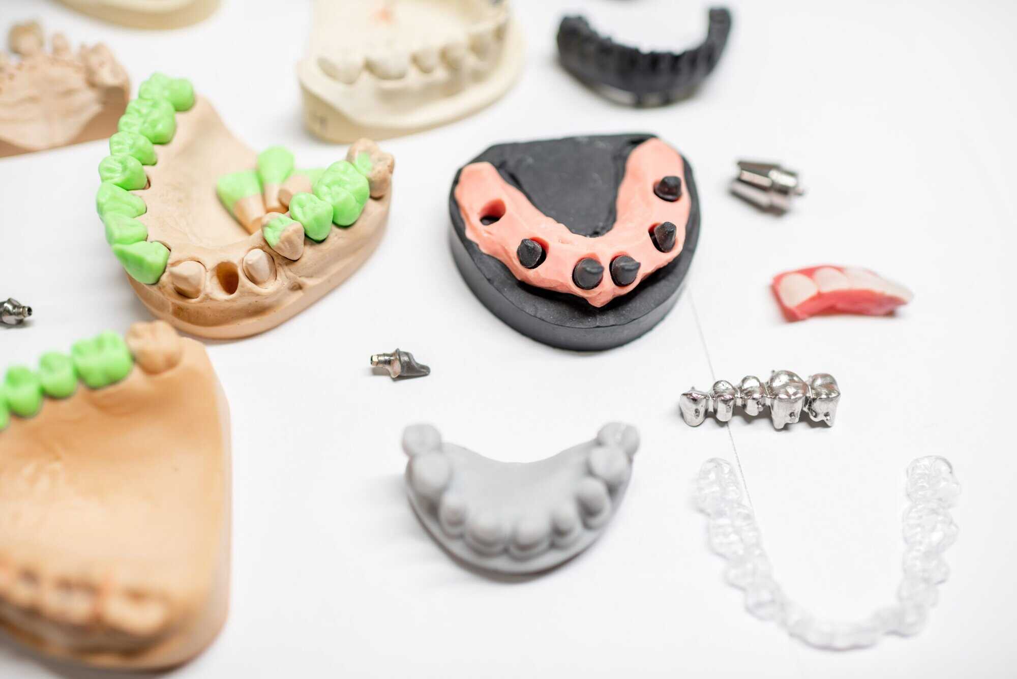 options for replacing missing teeth